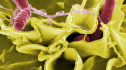 FDA Tarik Produk Suplemen Moringa Rosabella Akibat Kontaminasi Bakteri Salmonella