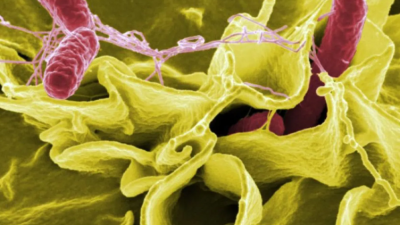 FDA Tarik Produk Suplemen Moringa Rosabella Akibat Kontaminasi Bakteri Salmonella