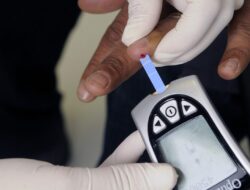 Berikut Lima Tanda-tanda Kolesterol Tinggi pada Wanita